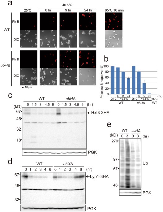 Accelerated invagination of vacuoles as a stress response in chronically heat-stressed yeasts
