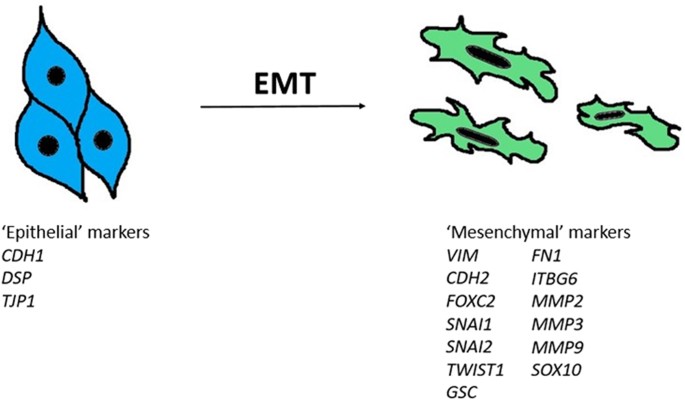 Epithelial Mesenchymal Transition Emt Signature Is Inversely Associated With T Cell Infiltration In Non Small Cell Lung Cancer Nsclc Scientific Reports