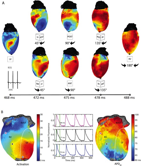 RHYTHM An Open Source Imaging Toolkit for Cardiac Panoramic Optical