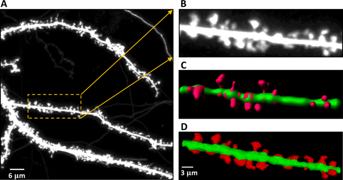 Quantitative 3-D morphometric analysis of individual dendritic spines ...