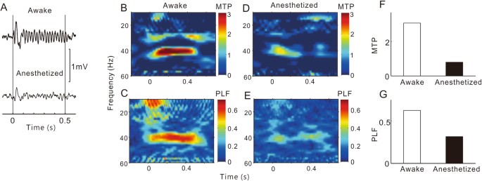 Differential Modulation Of The Auditory Steady State Response And Inhibitory Gating By Chloral Hydrate Anesthesia Scientific Reports