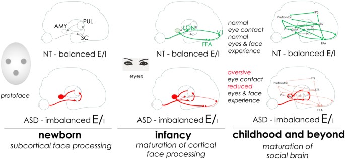 Bumetanide For Autism More Eye Contact Less Amygdala Activation Scientific Reports
