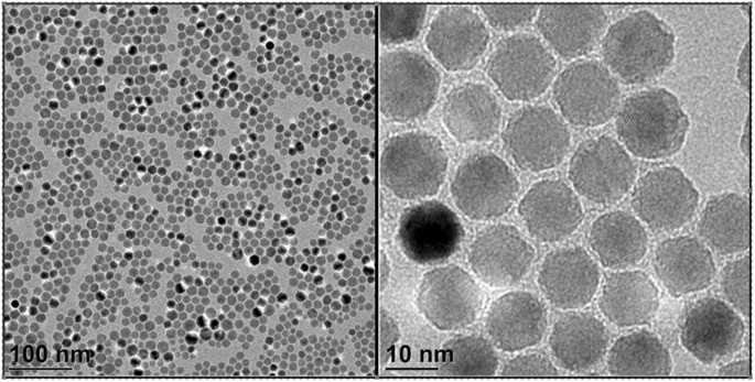 Potential use of superparamagnetic iron oxide nanoparticles for in vitro  and in vivo bioimaging of human myoblasts | Scientific Reports