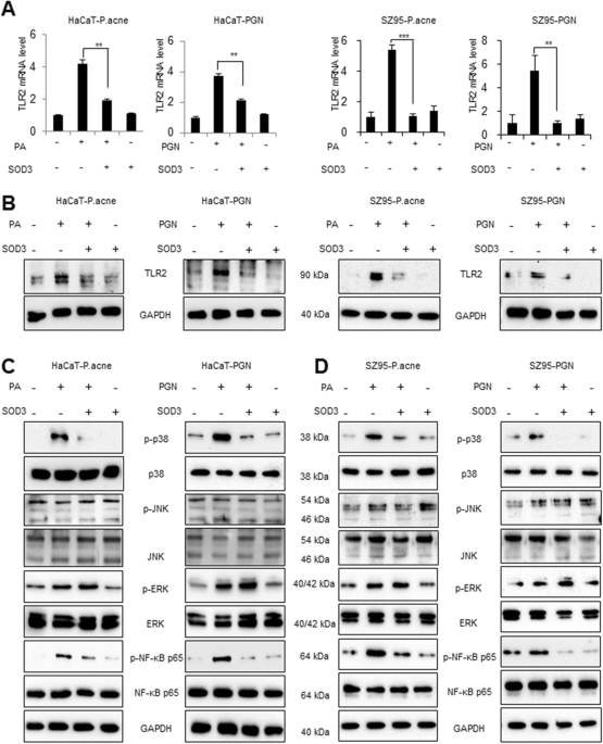 Inhibitory Effects Of Superoxide Diase 3 On Propionibacterium A B Hacat And Sz95 Cells Were Pretreated With Sod3 200 U Ml Incubated Heat Killed P