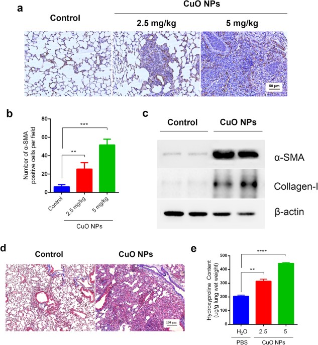 Intranasal Delivery of Copper Oxide Nanoparticles Induces Pulmonary