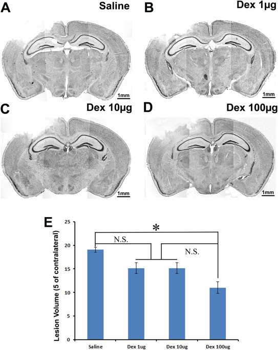 dihexa traumatic brain injury Neuroprotective effect of dexmedetomidine in a murine model of BPC-157 – APEXBioSystems Chemical Analog 4-Week Supply:Core