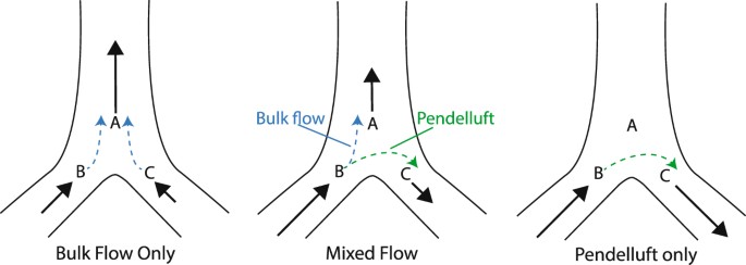 pendelluft COVID-19