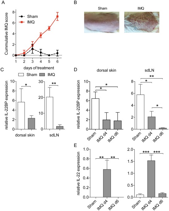 Regulation Of Il 22bp In Psoriasis Scientific Reports