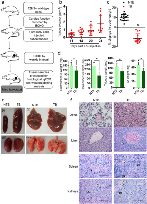 Subcutaneous Ehrlich Ascites Carcinoma mice model for ... brain model diagram 