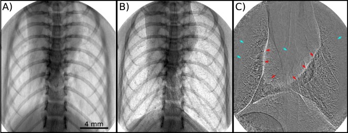 In vivo Dynamic Phase-Contrast X-ray Imaging using a Compact Light Source |  Scientific Reports