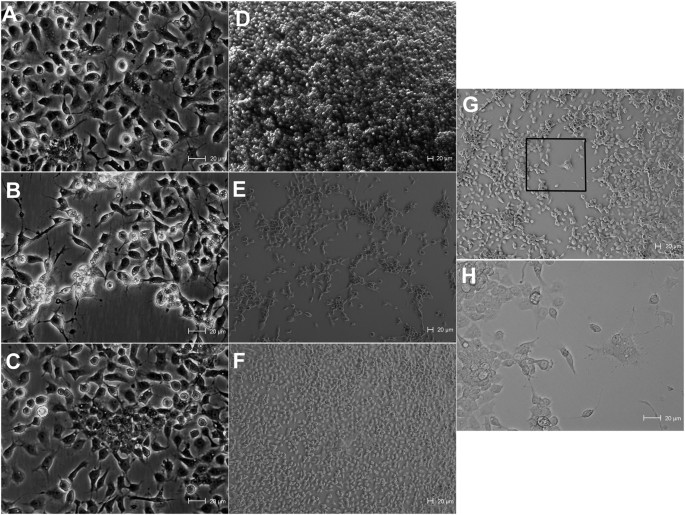 Wolbachia Significantly Impacts The Vector Competence Of Aedes Aegypti For Mayaro Virus Scientific Reports