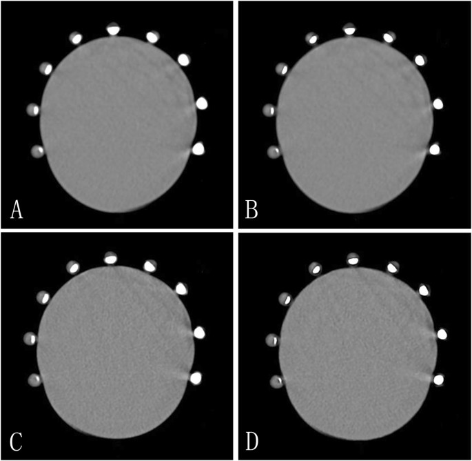 Blooming Artifact Reduction in Coronary Artery Calcification by A New ...