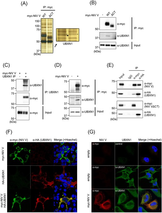 Possible role of the nipah virus v protein in the regulation of the interferon beta induction by interacting with ubx domain-containing protein1