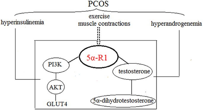 Hyperandrogenism And Hyperinsulineare Main Clinical Endocrine Features Of Pcos Exercise Can Adjust The Androgen Level As Well As Increase The Hyperandrogenism And Hyperinsulineare Main Clinical Endocrine Features Of Pcos Exercise Can Adjust The Androgen Level As Well As Increase The