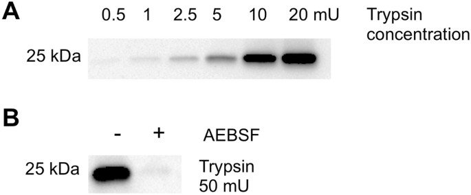 Functional Proteomic Profiling Of Secreted Serine Proteases In Health And Inflammatory Bowel Disease Scientific Reports