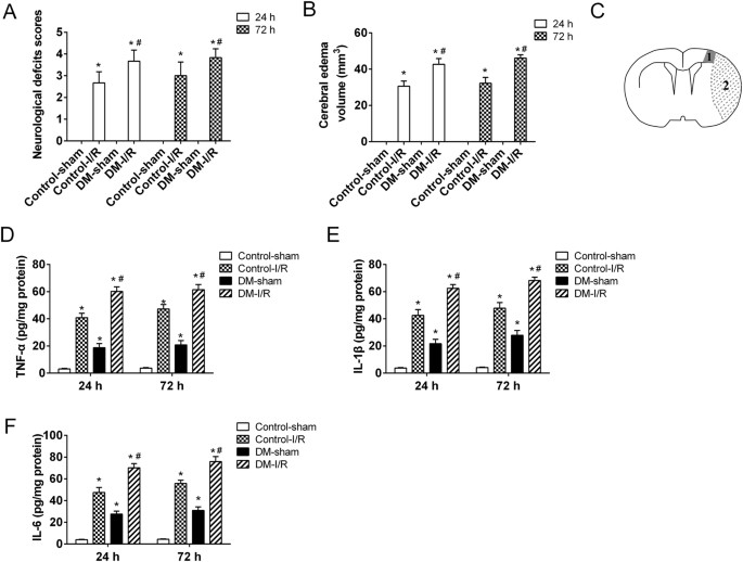 Lncrna malat1 promotes high glucose-induced inflammatory response of microglial cells via provoking myd88/irak1/traf6 signaling