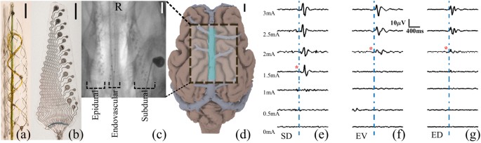 Signal Quality Of Simultaneously Recorded Endovascular Subdural And Epidural Signals Are Comparable Scientific Reports