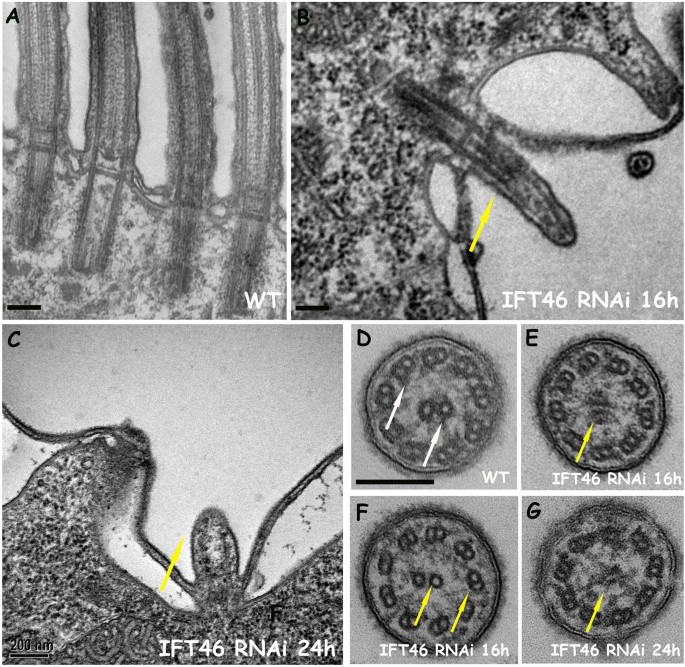 Intraflagellar transport 46 (IFT46) is essential for trafficking IFT ...