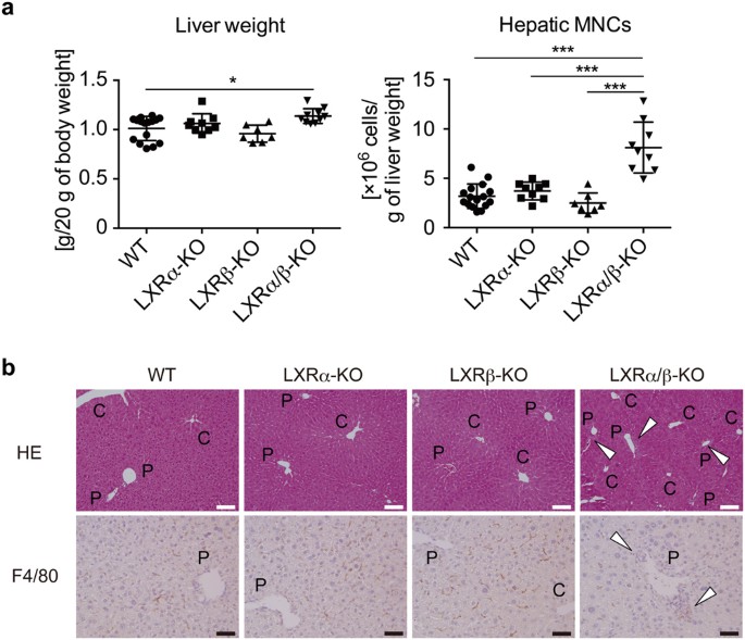 Liver X receptors regulate hepatic F4/80 + CD11b + Kupffer cells
