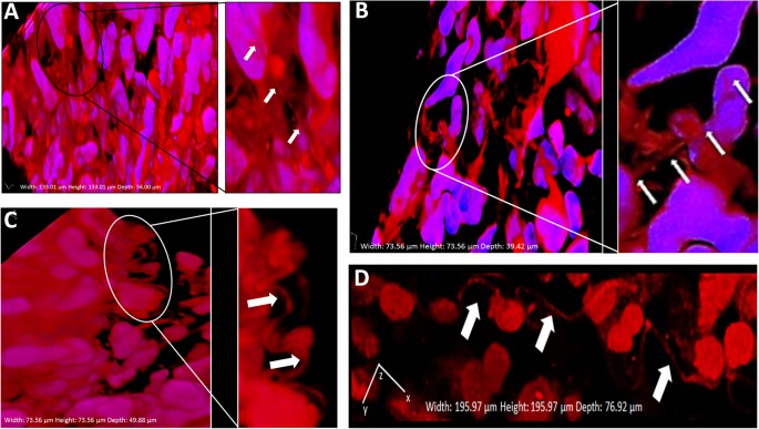 Chemotherapy Induced Tunneling Nanotubes Mediate Intercellular Drug Efflux In Pancreatic Cancer Scientific Reports Chemotherapy Induced Tunneling Nanotubes Mediate Intercellular Drug Efflux In Pancreatic Cancer Scientific Reports