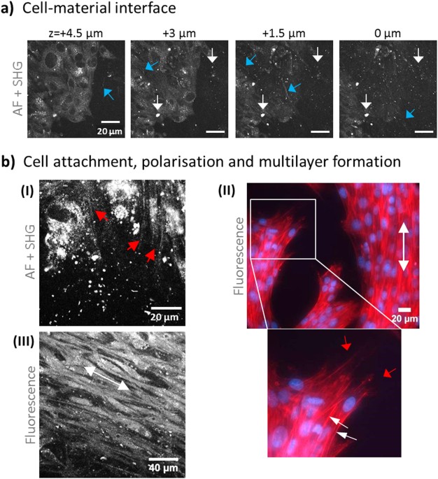 Bacterial nanocellulose stimulates mesenchymal stem cell expansion and  formation of stable collagen-I networks as a novel biomaterial in tissue  engineering