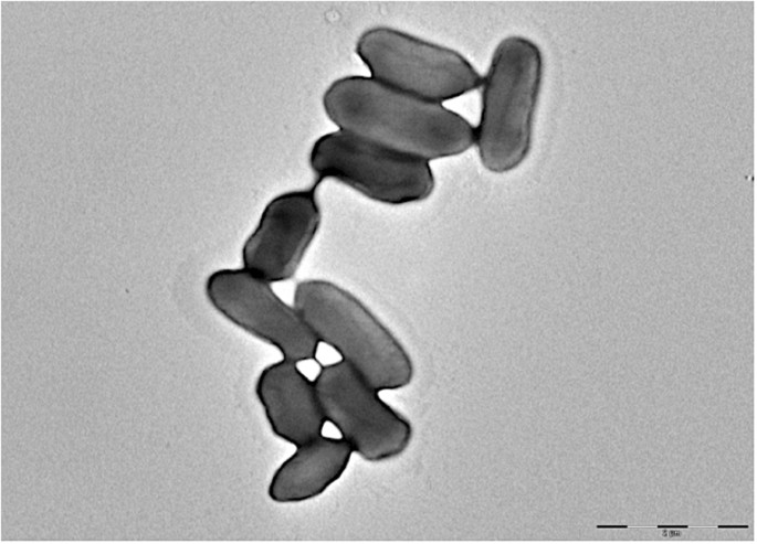 Genomic analysis of a Raoultella ornithinolytica strain ...