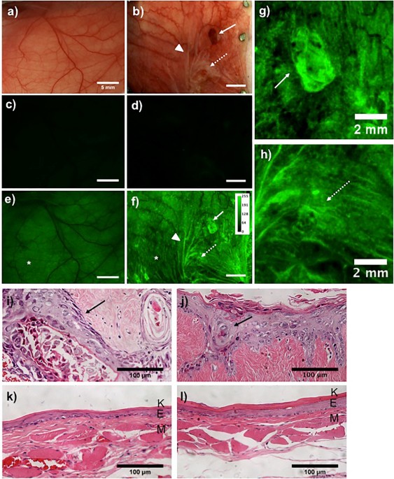 In-vivo validation imaging of a hamster cheek pouch: (A) fluorescence