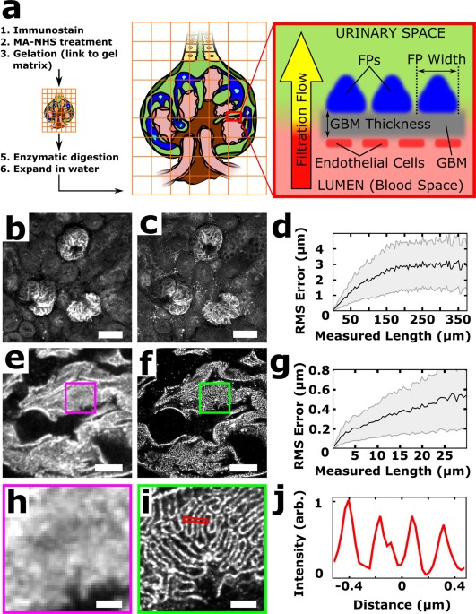 Volumetric, nanoscale optical imaging of mouse and human kidney via expansion microscopy