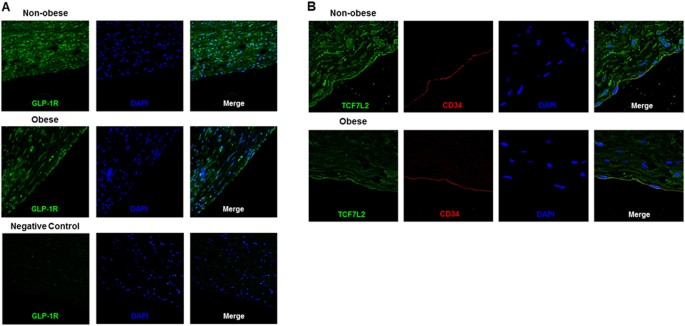 glp 1 receptor expression Down-regulation of vascular GLP-1 receptor expression in human subjects  with obesity