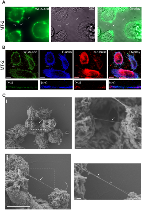 Inhibition Of Tunneling Nanotube Tnt Formation And Human T Cell Leukemia Virus Type 1 Htlv 1 Transmission By Cytarabine Scientific Reports