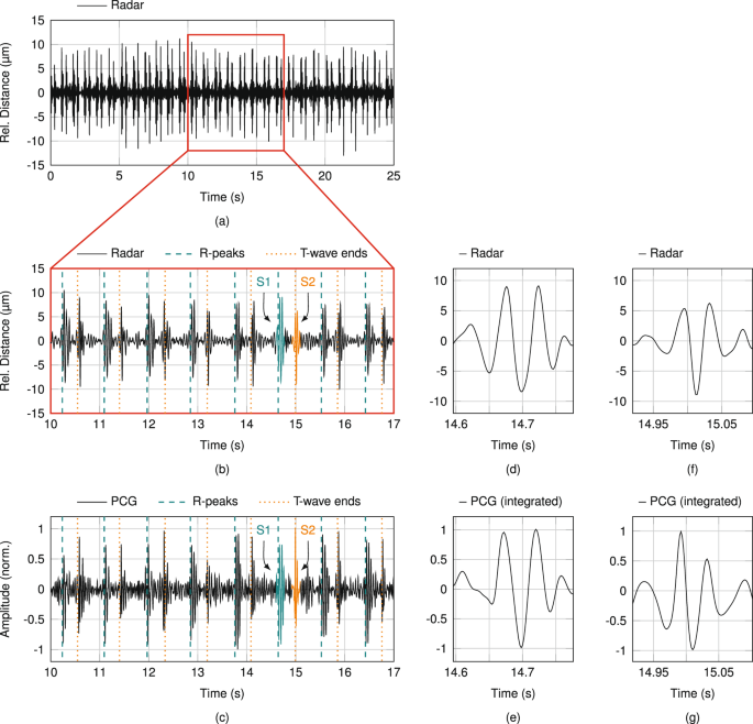 Detecting Your Heart Rate