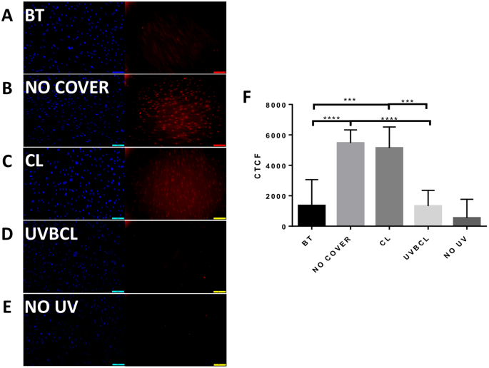 UV lightblocking contact lenses protect against shortterm UVBinduced