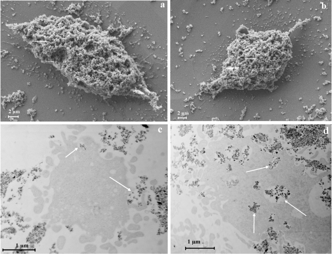 FeCrNbB particles with shape anisotropy for cancer cell destruction by