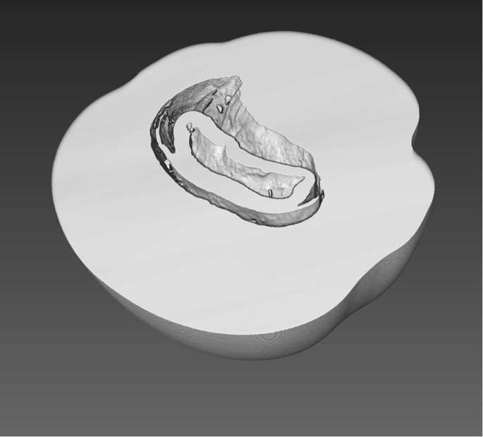 Characterizing pearls structures using X-ray phase ...
