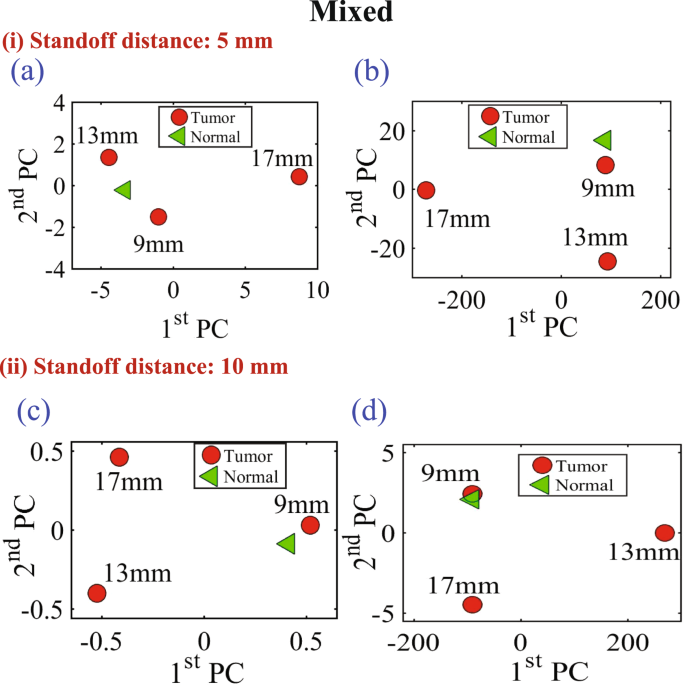 Near Field Breast Tumor Detection Using UltraNarrow Band Probe with
