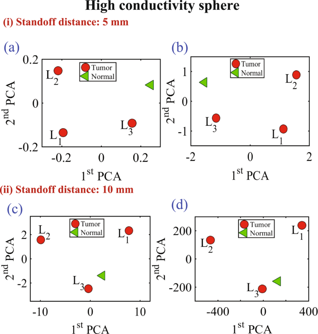 Near Field Breast Tumor Detection Using UltraNarrow Band Probe with