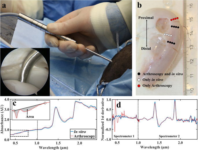 Arthroscopic Near Infrared Spectroscopy Enables Simultaneous Quantitative Evaluation Of Articular Cartilage And Subchondral Bone In Vivo Scientific Reports