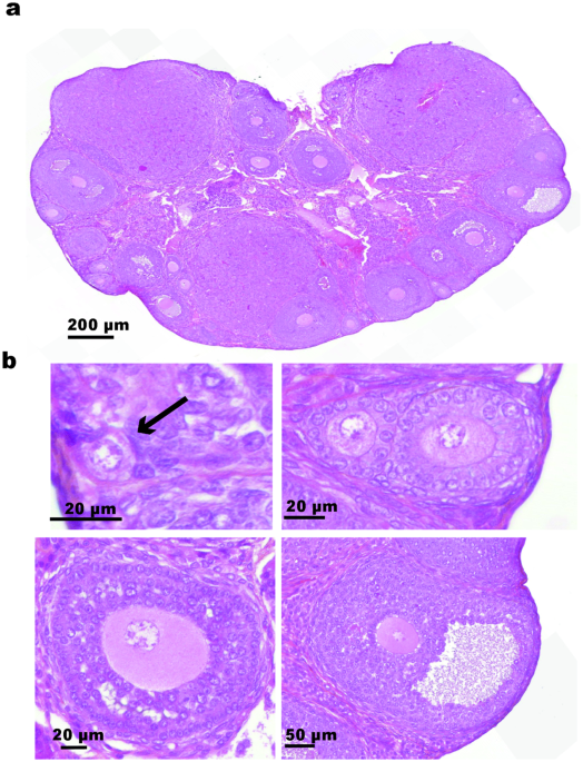 high throughput ovarian follicle counting by an innovative deep