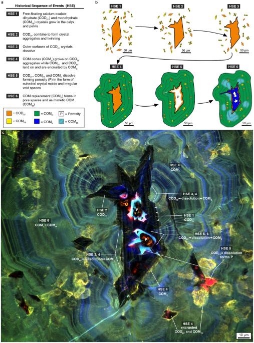 Simulate imply newspaper Geobiology reveals how human kidney stones dissolve in vivo | Scientific Reports Simulate imply newspaper Geobiology reveals how human kidney stones dissolve in vivo | Scientific Reports