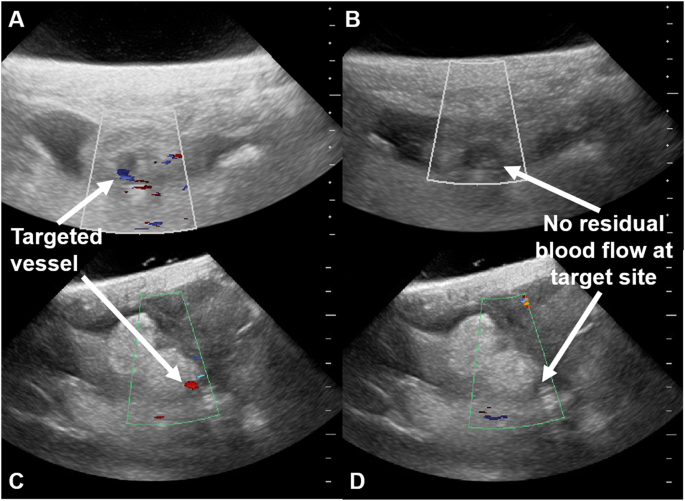 Suspect flank pain? Consider ultrasound for first-line imaging • APPLIED  RADIOLOGY