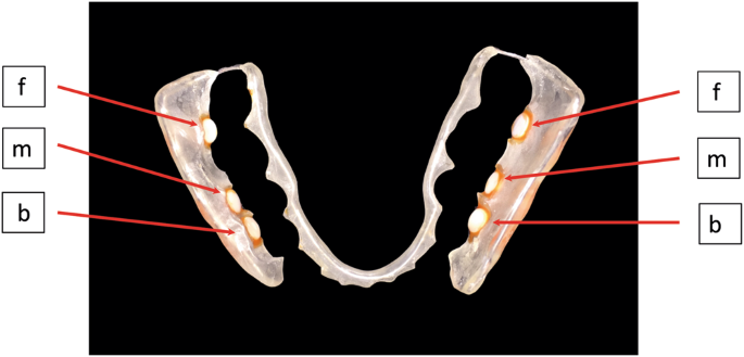 weisseradler script download In-vivo shift of the microbiota in oral biofilm in response to.