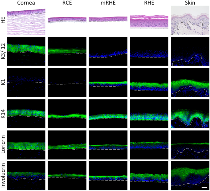 Protective effect of high concentration of BN52021 on retinal contusion in  cat eyes, BMC Ophthalmology