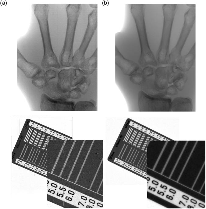 Direct Thermal Growth Of Large Scale Cl-doped CdTe Film For Low Voltage ...