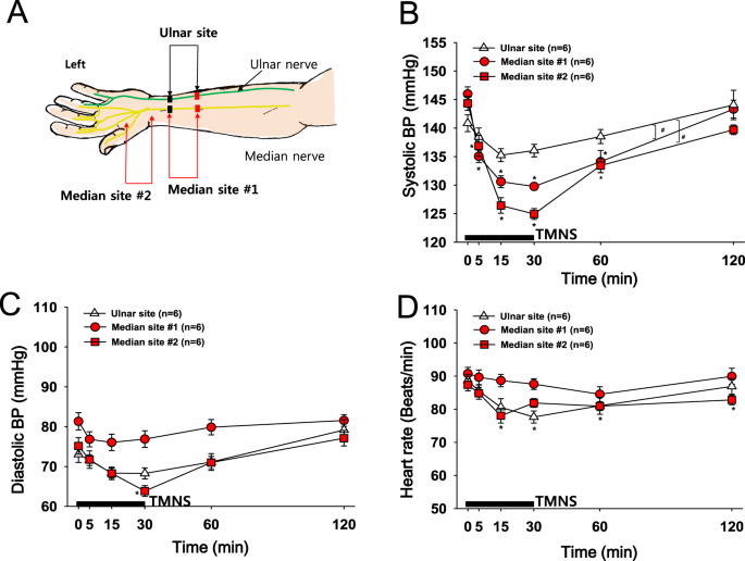 Attenuation of hypertension by C-fiber stimulation of the human