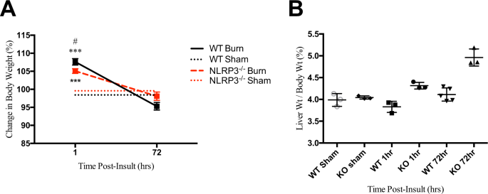 Nlrp3 inflammasome modulates post-burn lipolysis and hepatic fat infiltration via fatty acid synthase