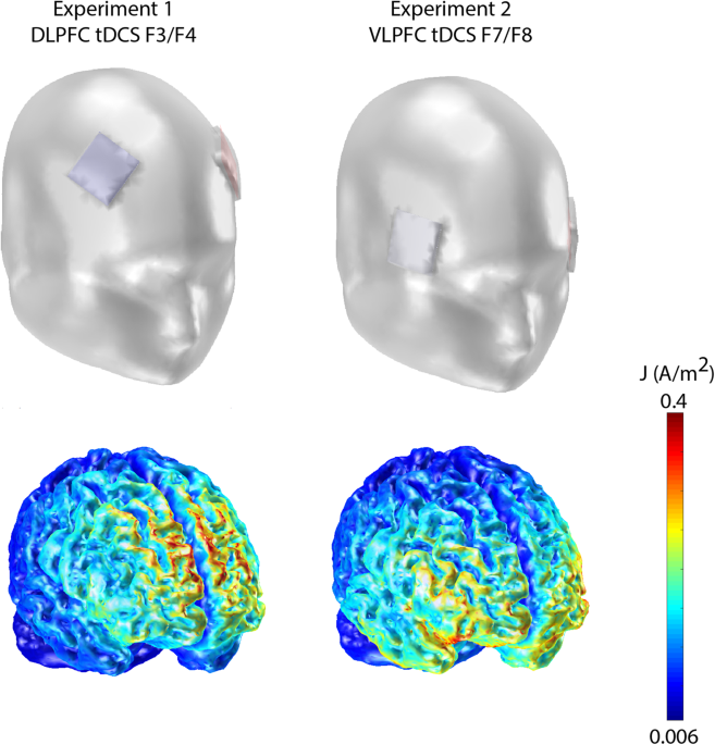 dorsolateral prefrontal cortex tdcs