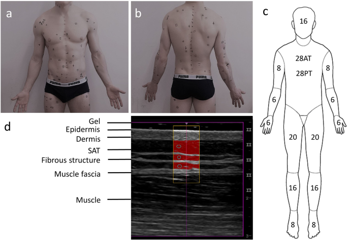 A-mode and B-mode ultrasound measurement of fat thickness: a cadaver  validation study