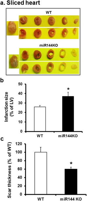 Loss Of Mir 144 Signaling Interrupts Extracellular Matrix Remodeling