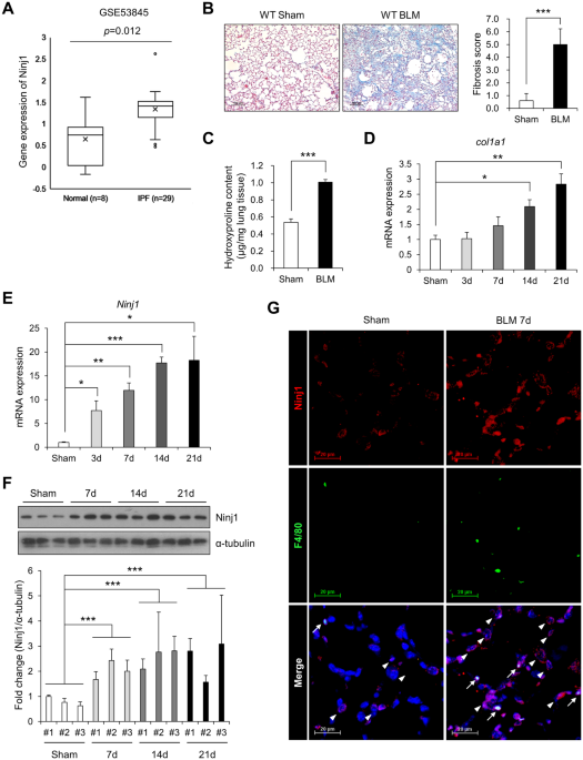 Ninjurin1 Plays a Crucial Role in Pulmonary Fibrosis by Promoting ... Ninjurin1 Plays a Crucial Role in Pulmonary Fibrosis by Promoting ...