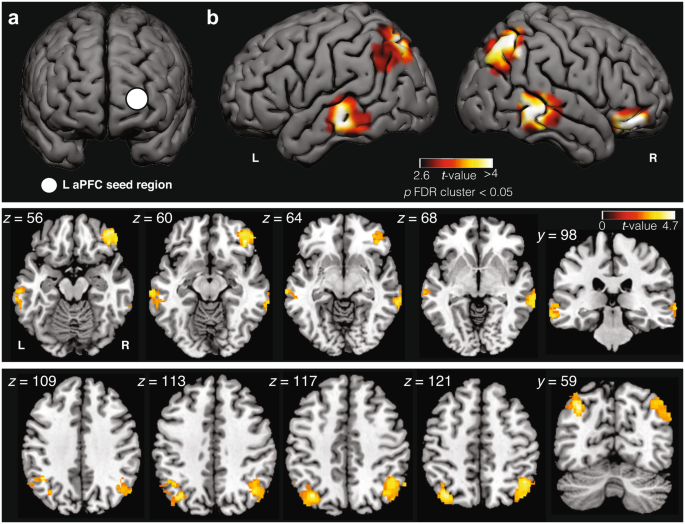 Frequent lucid dreaming associated with increased functional connectivity  between frontopolar cortex and temporoparietal association areas |  Scientific Reports